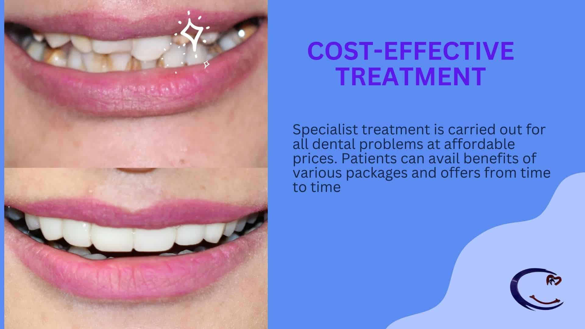 Dental treatments by Dr. Ramandeep Singh Chawla